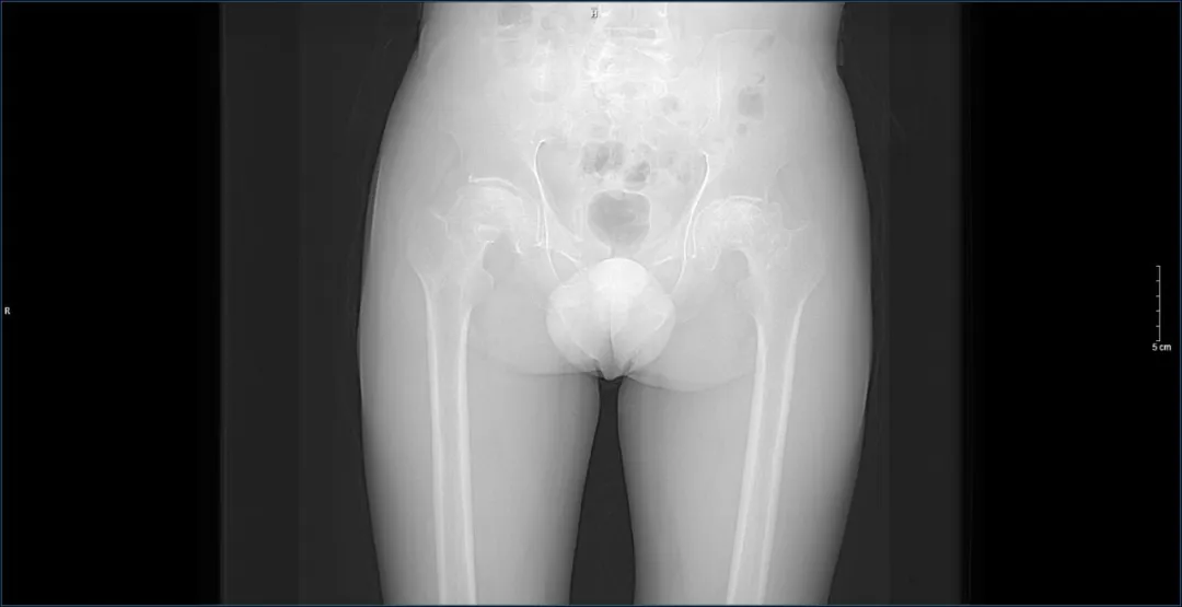 济南南郊医院骨二科团队再获患者锦旗致谢