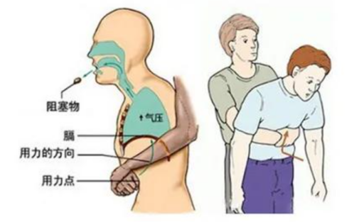 120国家急救日|关爱生命,“救”在身边
